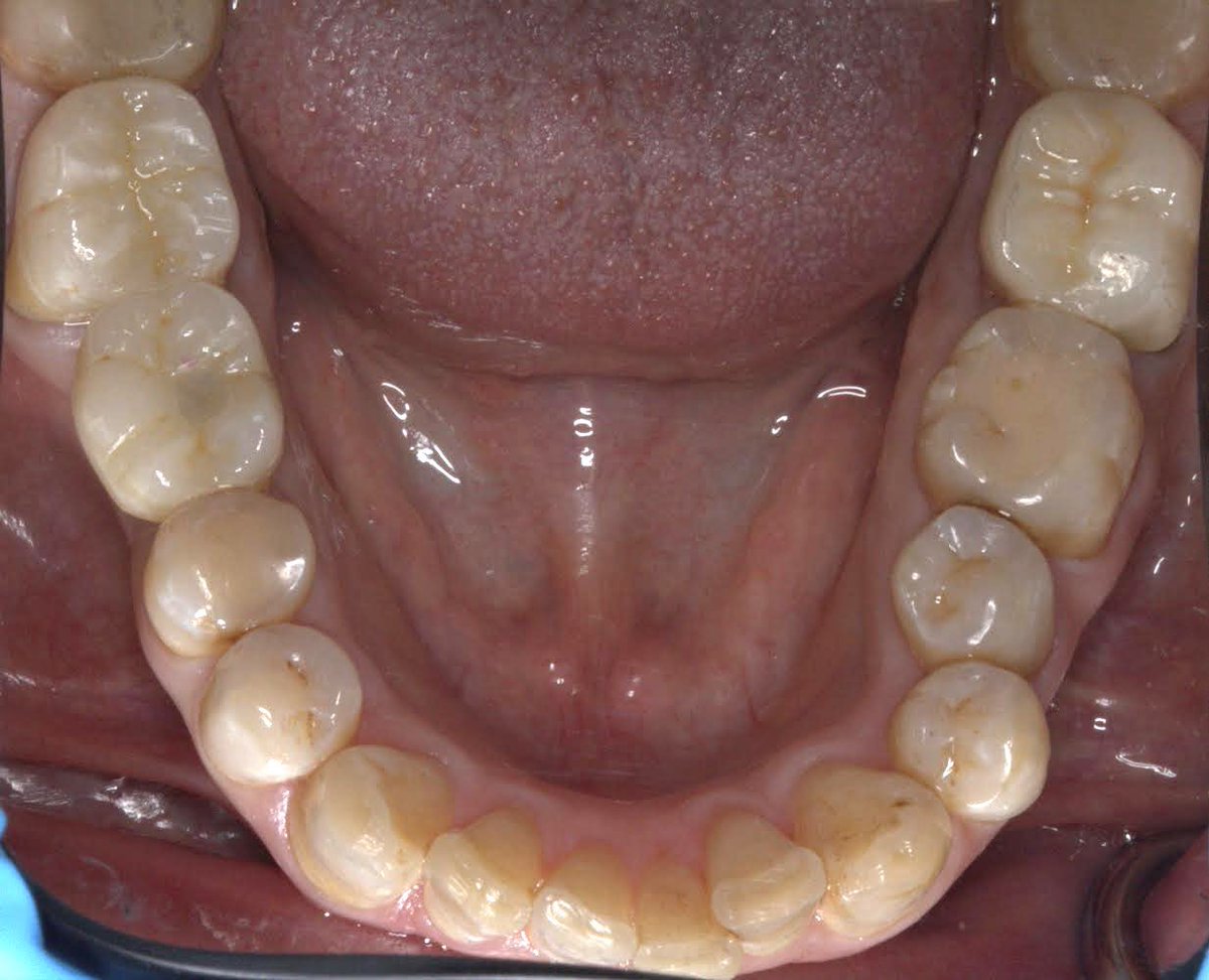 Abdulelah Alqahtani | د.عبدالاله القحطاني tweet media