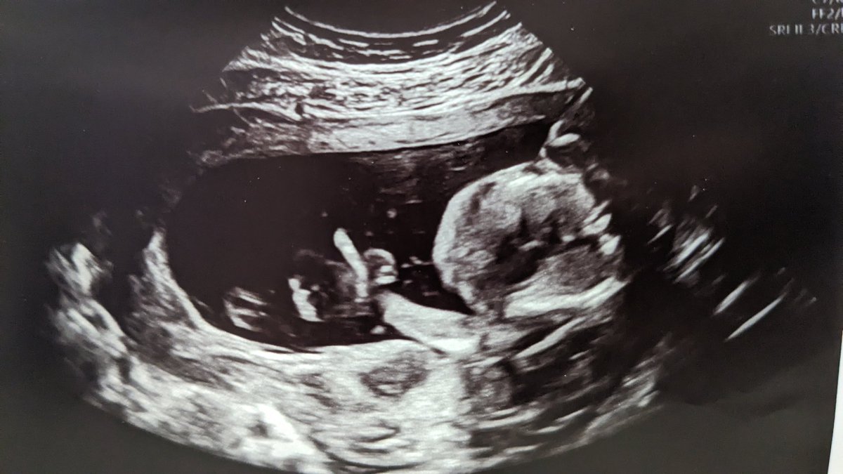 Jocelyn Kearney tweet media