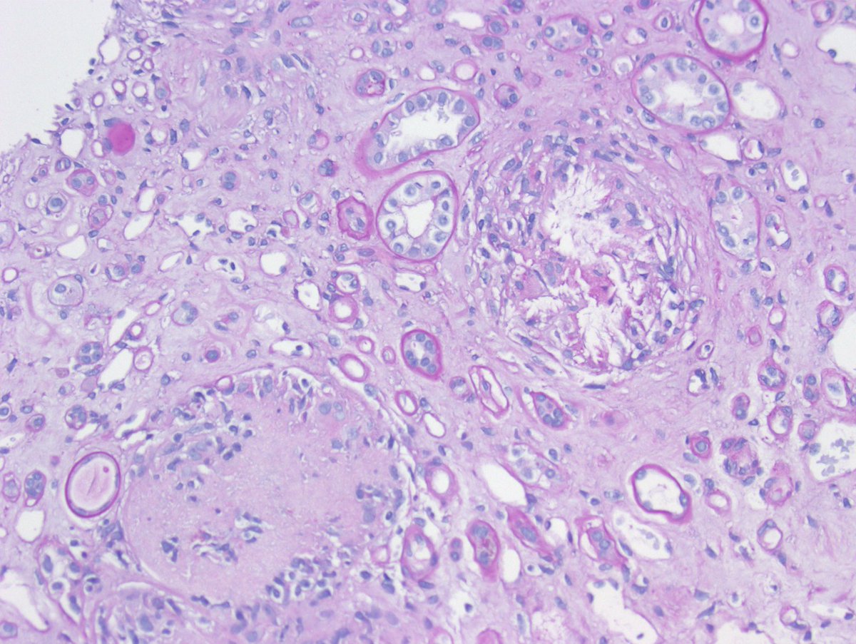 Kuang-Yu Jen, MD, PhD tweet media