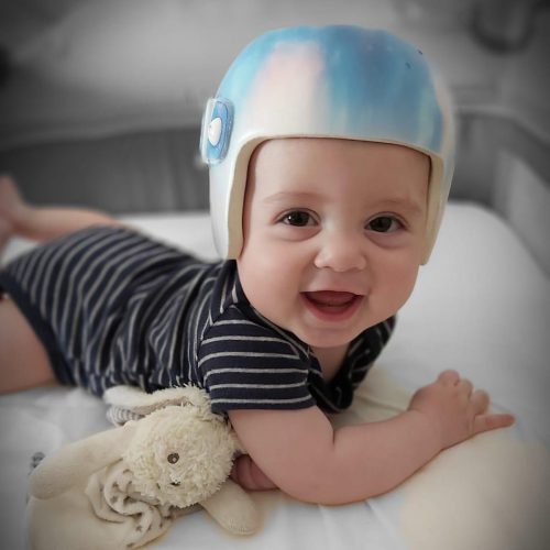 29 MAYO - 18 HORAS.
Asiste EN DIRECTO a la #MasterClass sobre #OrtesisCraneal de los #alumnos de último curso de Ortoprótesis y Productos de Apoyo de la <a href="/ERyCBarcelona/">Escola Ramón y Cajal</a>. 
Las nuevas generaciones de la #ortopedia en 👉👉meet.google.com/cav-zyhn-yer
¡Te esperamos!