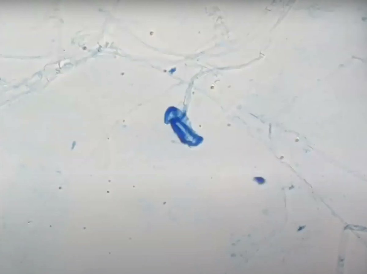 🔬 What’s under the microscope? A mushroom? A squished blue smurf?

Summer Scholar student Matt Oxfam shows us phytophthora in it’s true form. Find out more on his presentation here. 💁‍♀️ buff.ly/43buwet
