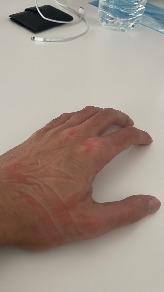 pov: la mejor siesta de la historia