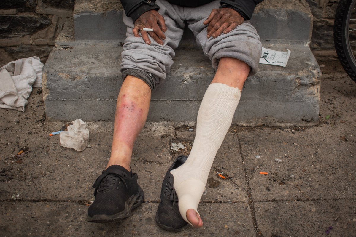 An in-depth feature on tranq--a devastating drug that's popping up around the U.S., plus some extra photos from my reporting: time.com/6280860/xylazi…
Edited by @Mayanyani