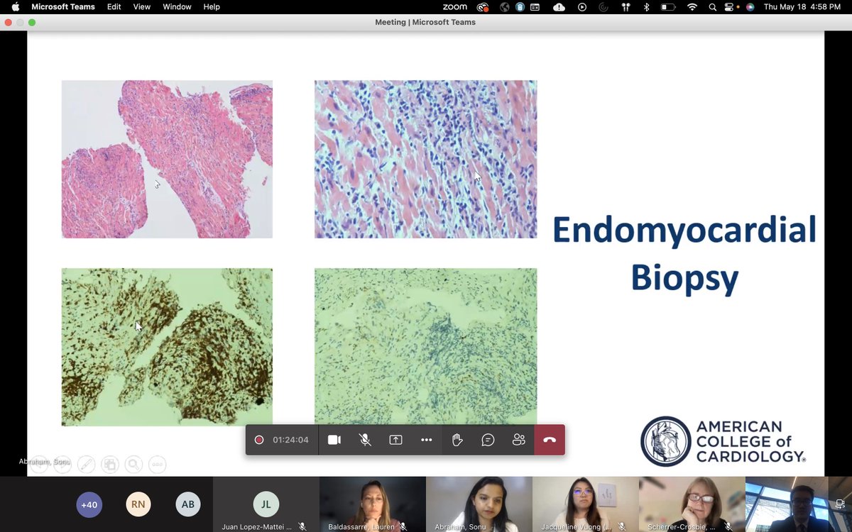 Great <a href="/ACCinTouch/">American College of Cardiology</a> webinar on the use of multimodality imaging in complex #cardioonc cases! 

Kudos to the phenomenal presentations of the fellows, residents (slightly biased but GO <a href="/DOM_UCLA/">Department of Medicine at UCLA Health</a> <a href="/JTVuongMD/">Jacqueline Vuong</a>!!) &amp; their mentors in showing that nothing is straightforward in this field!