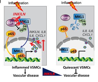 Circulation (@circaha) on Twitter photo #OriginalResearch: A novel long noncoding RNA, #INKILN, promotes inflammation in #VascularSmoothMuscleCells and is induced in atherosclerosis and aortic aneurysms #AHAJournals @LarsMaeg <a href="/clintomics/">Clint Miller</a> <a href="/yaoweilu/">Yao Wei Lu</a> <a href="/NestorIshimwe/">Nestor ISHIMWE</a> <a href="/barrosolab/">Margarida M Barroso</a> ahajournals.org/doi/10.1161/CI… #OriginalResearch: A novel long noncoding RNA, #INKILN, promotes inflammation in #VascularSmoothMuscleCells and is induced in atherosclerosis and aortic aneurysms #AHAJournals @LarsMaeg <a href="/clintomics/">Clint Miller</a> <a href="/yaoweilu/">Yao Wei Lu</a> <a href="/NestorIshimwe/">Nestor ISHIMWE</a> <a href="/barrosolab/">Margarida M Barroso</a> ahajournals.org/doi/10.1161/CI…