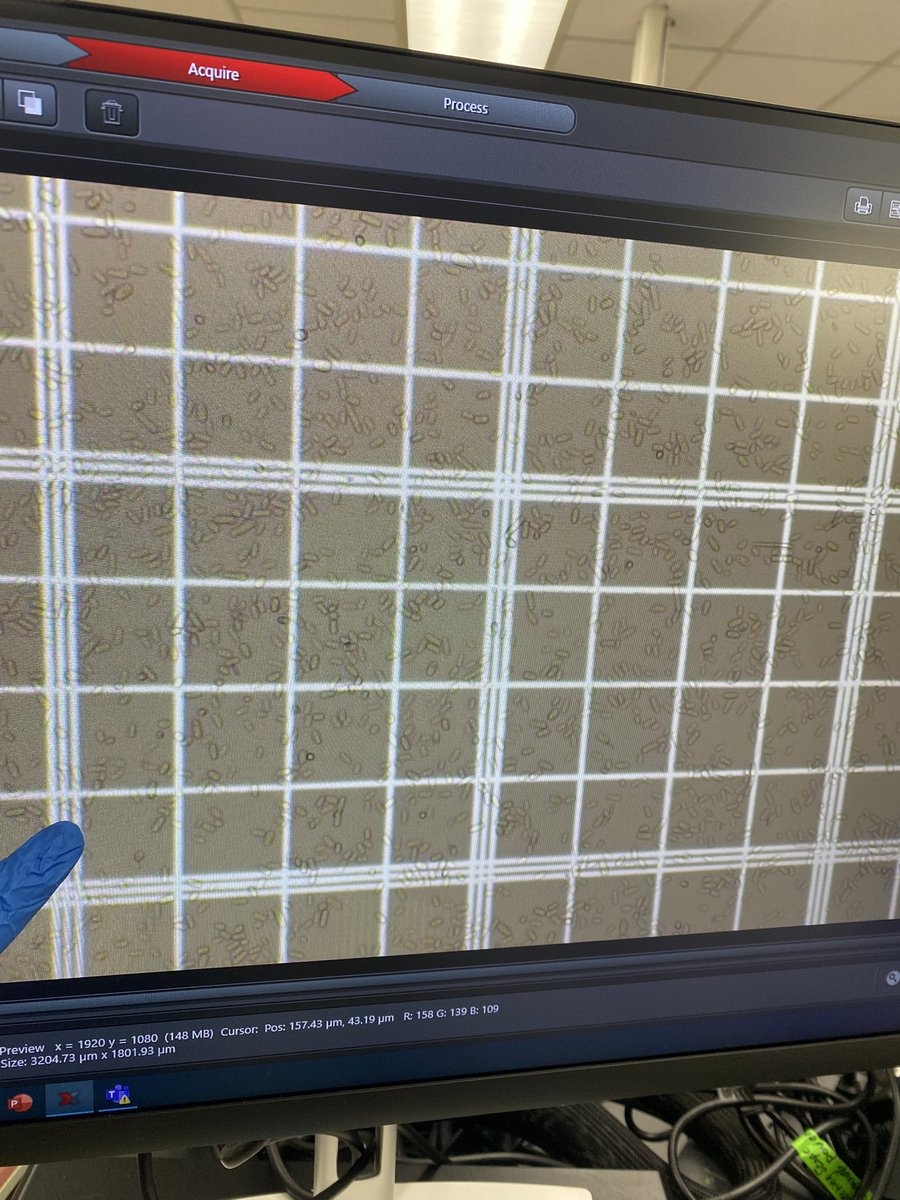 Karan Chahal, PhD ππ³π¬π§«π§¬π§ͺπ (@karan_plantpath) on Twitter photo Showing preparation of fungal spore suspensions to Ethan, not on Twitter, new MS student in <a href="/MLSakalidis/">Dr. Monique L Sakalidis</a> lab. He was surprised seeing sporulation potential of #oakwilt fungus in vivo and invitro, good for plant pathologists but sad for oaks!! Showing preparation of fungal spore suspensions to Ethan, not on Twitter, new MS student in <a href="/MLSakalidis/">Dr. Monique L Sakalidis</a> lab. He was surprised seeing sporulation potential of #oakwilt fungus in vivo and invitro, good for plant pathologists but sad for oaks!!