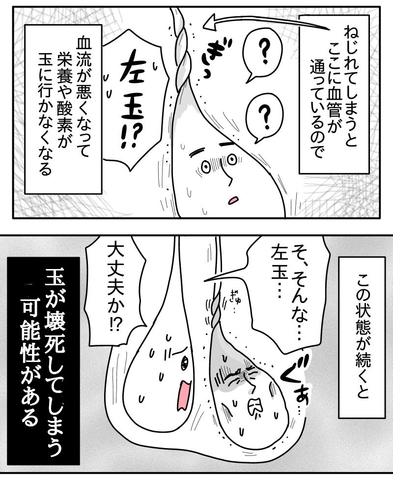 (2/4) 精巣捻転とは