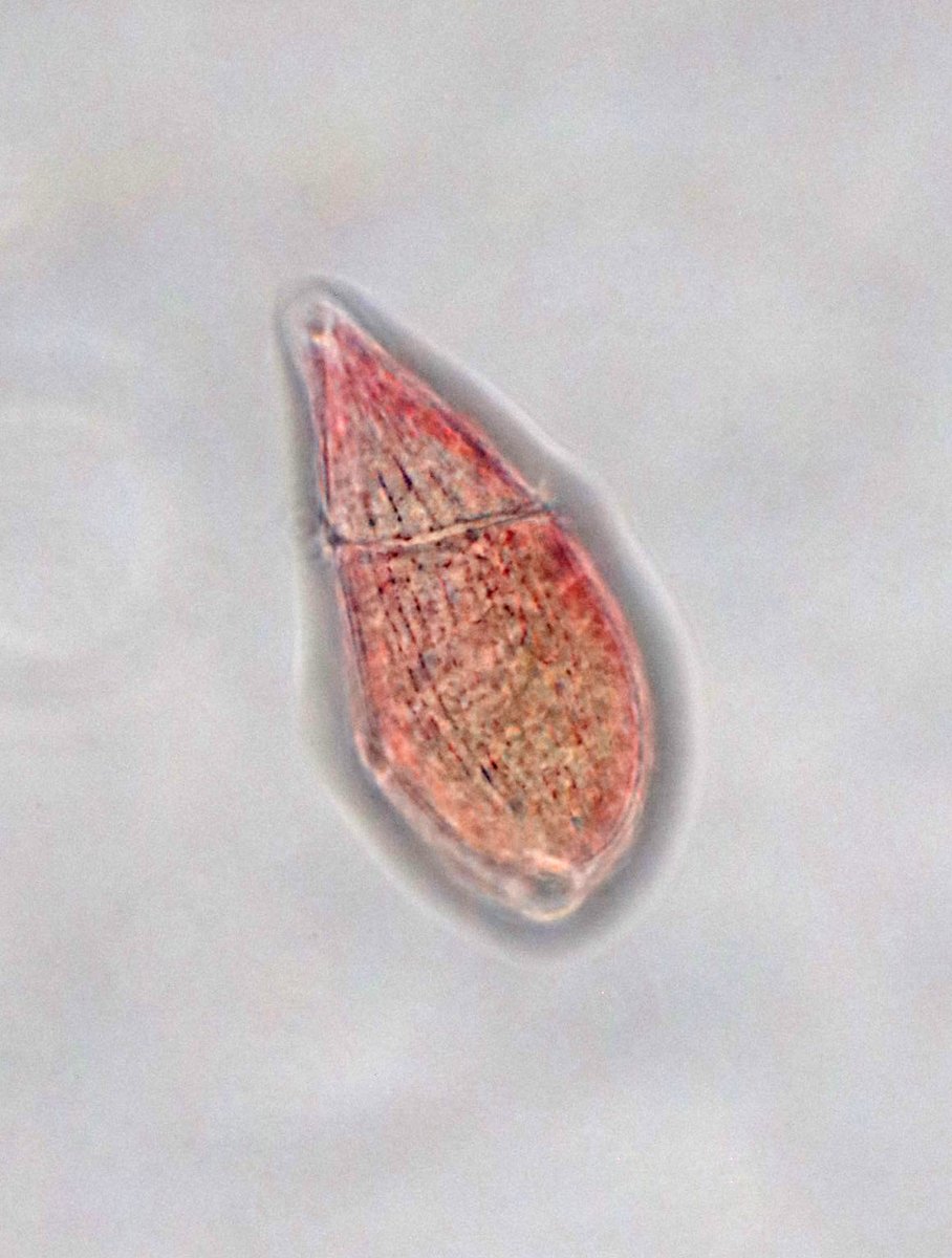 Today in the Pacific Ocean #Diatoms and #Dinoflagellates #phytoplankton