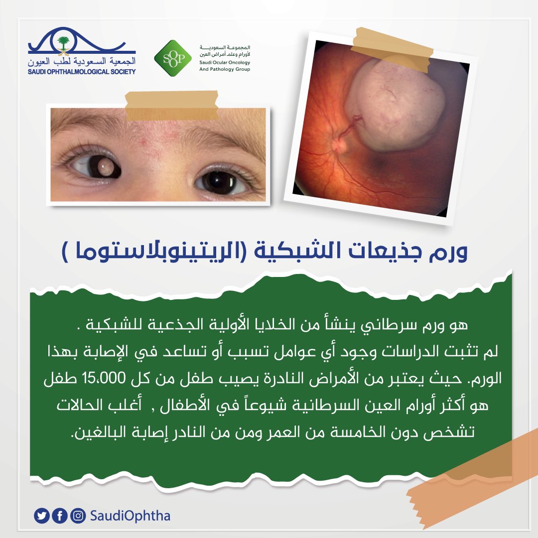 الجمعية السعودية لطب العيون SOS tweet media