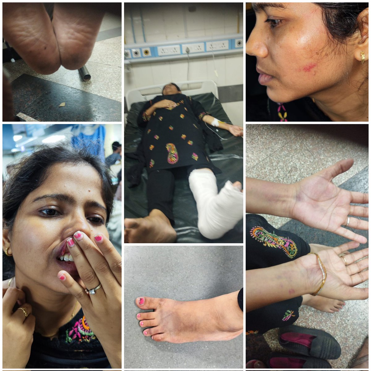 DilipMi75082467's tweet photo. स्वसेवक adv हरिकेश शर्मा और उनके assitanat  साधना यादव पर #एंटॉप_हिल पुलिस स्थानक के वरिष्ठ पुलिस अधिकारी #नसीर_कुलकर्णी द्वारा बहुत ही बुरी तरह उत्पीड़न किया गया, साथ ही बिना कोई कारण दोनो को बहुत बुरी तरह पीटा...
  बजरंग दल सदस्य जय बरनवाल द्वारा इसकी जानकारी प्राप्त होते.(१/२) https://t.co/eQQI4Ltkhx