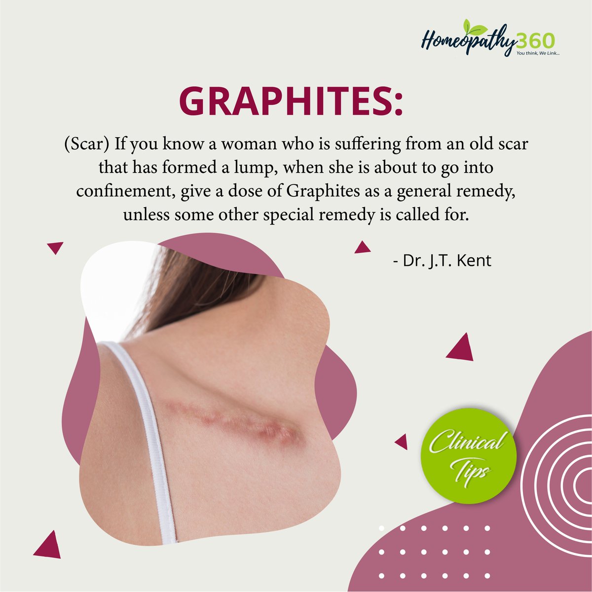 homeopathy360's tweet photo. Today Clinical Tips Graphites: Dr. J.T. Kent

Read More: https://t.co/OLWzJSwrHW

Searching tags: #Graphites, #DrHughes, #DrJTKent, #homeopathy, #homeopathic, #health, #healthcare, #homeopathy360, #health https://t.co/1m3jGlssPG
