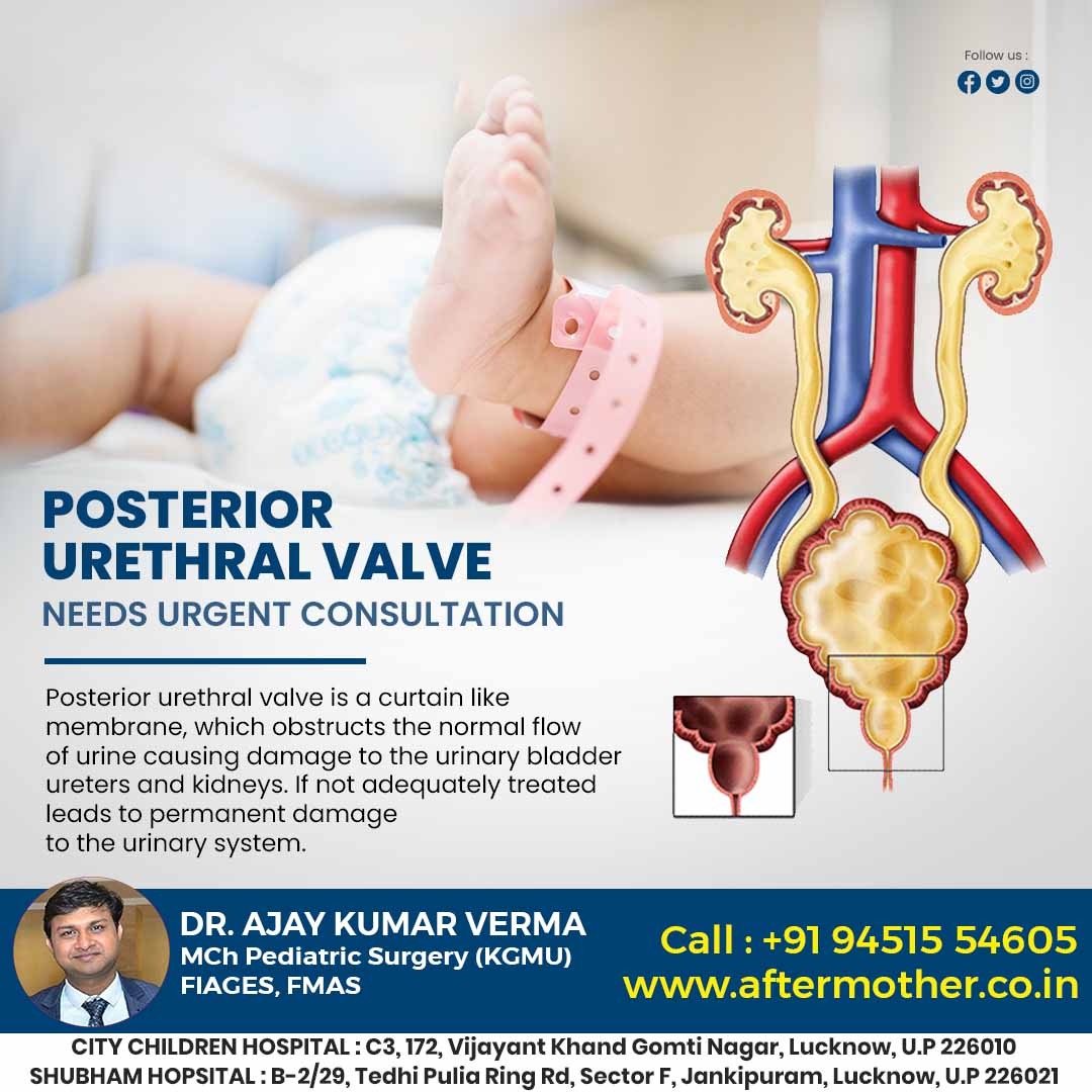 DrAjayKumarVer6's tweet photo. #PosteriorUrethral #Urethralvalve #kidsproblem #childworm #babycare #childcancer #pediatricurologists #lucknow
.
Dr. Ajay Verma
Consultant Neonatal and Pediatric Surgeon MBBS,MS,MCh.Pediatric Surgery(KGMU,Lucknow) FIAGES,FMAS
https://t.co/4FqaGwAqa1 https://t.co/RSf31O3Usc