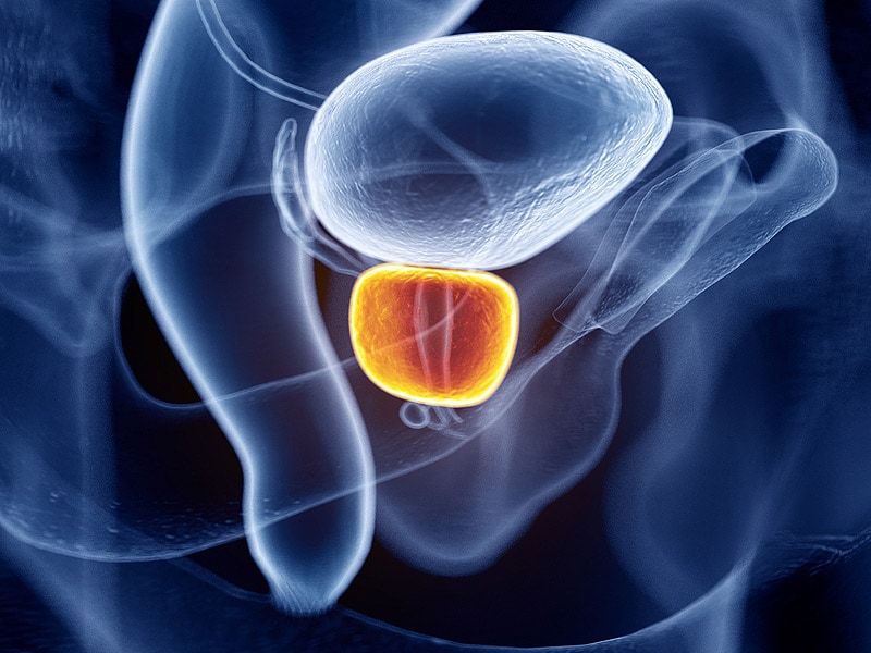 MedscapeES's tweet photo. Los hombres que tienen entre 0 y 3 eyaculaciones por mes tienen mayor riesgo de cáncer de próstata que quienes lo hacen con más frecuencia, según nuevo estudio español. https://t.co/gZwpNYvogo https://t.co/DLTpVccKWA