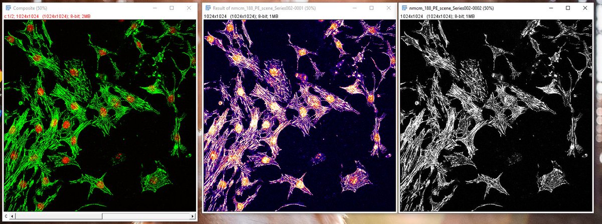 SwetaBioX's tweet photo. These pretty images are part of why I like working with bioimages so much! ππ€
#PhD #bioimages #deeplearning #cells https://t.co/R88gUGbU5V