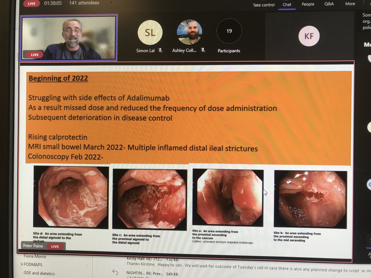 Kirstine Farrer (@kirstine_farrer) on Twitter photo Welcome to our north of England study day on IF and Crohn’s disease Dr Paine setting the scene <a href="/SimonLal_12/">SimonLal</a> <a href="/CathyCawley10/">Cathy Cawley</a> <a href="/ibdportal/">Cath Stansfield</a> <a href="/SimonHarrison4/">Simon Harrison</a> <a href="/sarahkelly200/">Sarah</a> <a href="/nicky_wyer/">Dr Nicky Wyer</a> <a href="/LJGemmell/">Lisa Gemmell</a> <a href="/NCAresearchNHS/">NCA Research NHS</a> Welcome to our north of England study day on IF and Crohn’s disease Dr Paine setting the scene <a href="/SimonLal_12/">SimonLal</a> <a href="/CathyCawley10/">Cathy Cawley</a> <a href="/ibdportal/">Cath Stansfield</a> <a href="/SimonHarrison4/">Simon Harrison</a> <a href="/sarahkelly200/">Sarah</a> <a href="/nicky_wyer/">Dr Nicky Wyer</a> <a href="/LJGemmell/">Lisa Gemmell</a> <a href="/NCAresearchNHS/">NCA Research NHS</a>