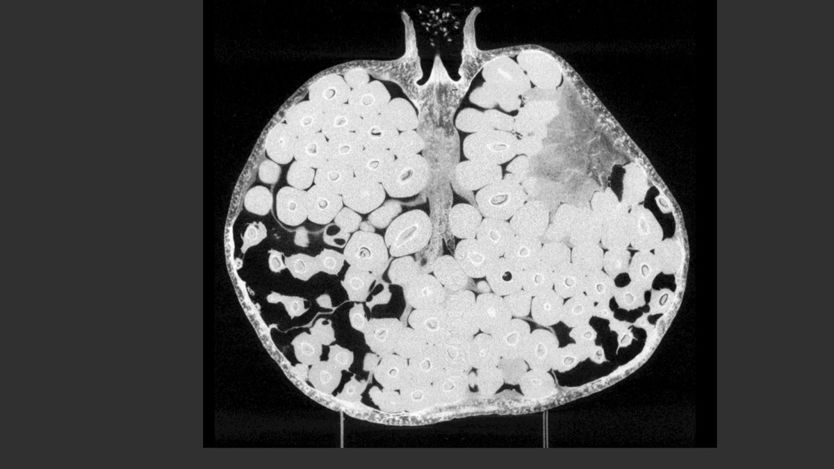 CT Scan of a pomegranate.
#xsightxray #nikonmetrology #microct #xray #industrialxray #xrayinspection #computedtomogrophy #industrialtomography #inspectionservices #nondestructivetesting #3dscanning #xrayimaging #ndt #ctscan #xrayct #qualityassurance #failureanalysis #3drendering