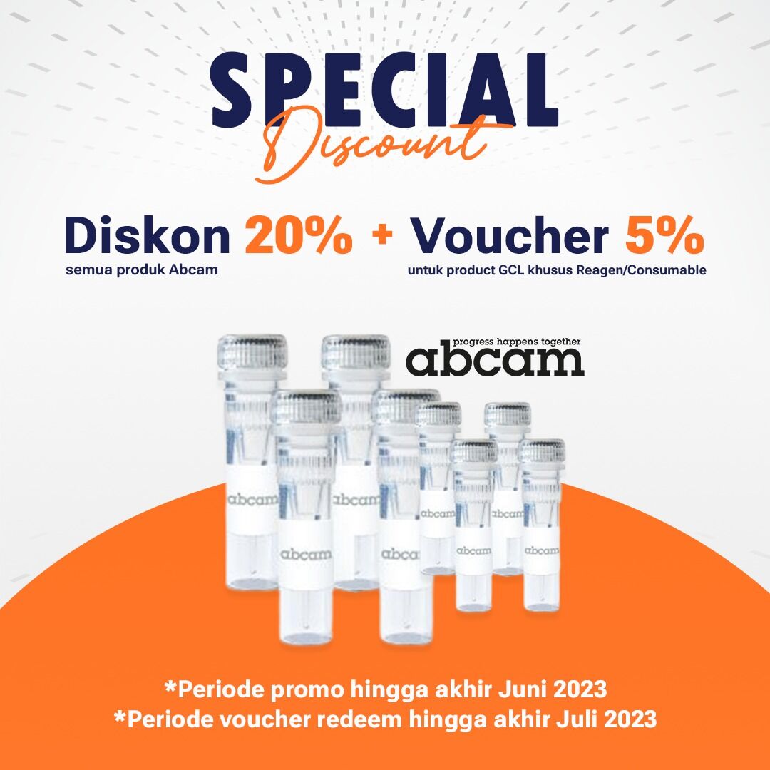 GeneCraftLabs's tweet photo. ⚠️ SPECIAL DISCOUNT ALERT🚨

Jika kamu memerlukan info &amp; bantuan dalam memilih produk yang tepat, jangan ragu untuk menghubungi kami di sales@genecraftlabs.com atau DM kami. 😉

#genecraftlabs #abcam #discounts #promotion #reagen #consumable #antibody #laboratorium #laboratory https://t.co/FrDlQAoqG7