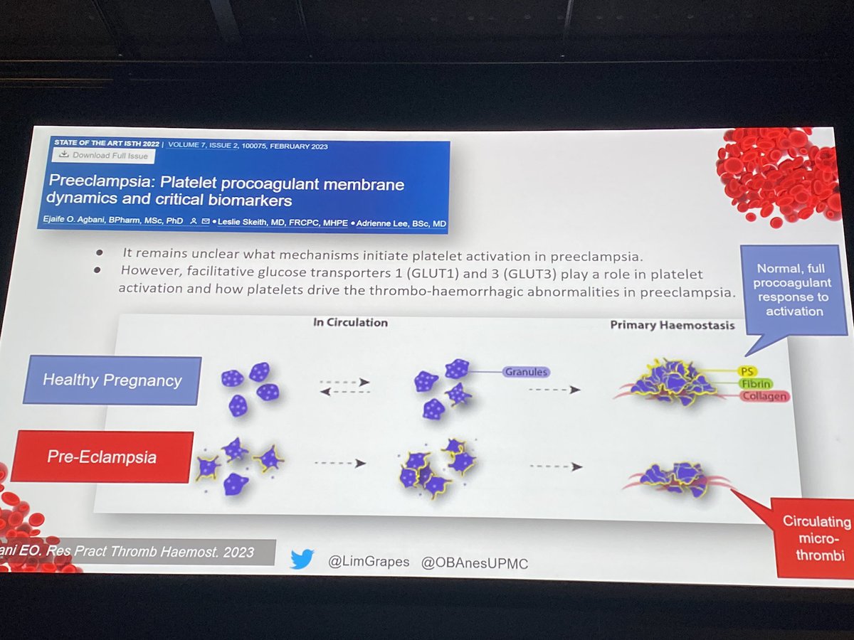 noolslucas's tweet image. Great talk on platelet function in preeclampsia from @LimGrapes at #OAA23ASM @OAAinfo @OAATrainee 

ncbi.nlm.nih.gov/pmc/articles/P…