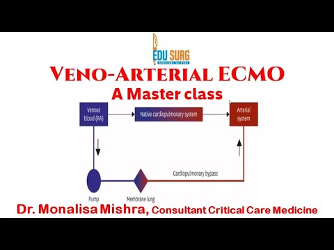 edusurg_clinics's tweet photo. Veno-Arterial ECMO (V-A ECMO) - Indications, #Ventilator Management, Life-Saving #Cardiac #Support. Click here to watch the full video: https://t.co/jeRSGS0Kzy  | https://t.co/jW3Qd5id5W

#VenoArterialECMO #ECMO #CardiacSupport  #MedicalStudent #OnlineLearning #Edusurgclinics https://t.co/wwVqiGriNF