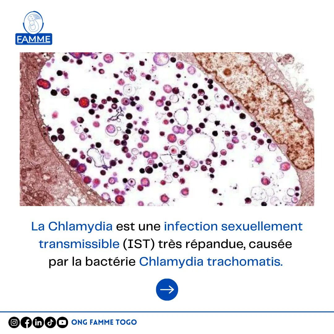 leTogoRT's tweet photo. RT @ONGFAMME: 🌟 Focus sur la Chlamydia : informez-vous et protégez-vous 🌟
La Chlamydia est une infection sexuellement transmissible (IST) très répandue
#FAMME #Chlamydia #IST #Prévention #Dépistage #SantéSexuelle #Reproductive #Togo #Protection https://t.co/i6VYCCbTLp