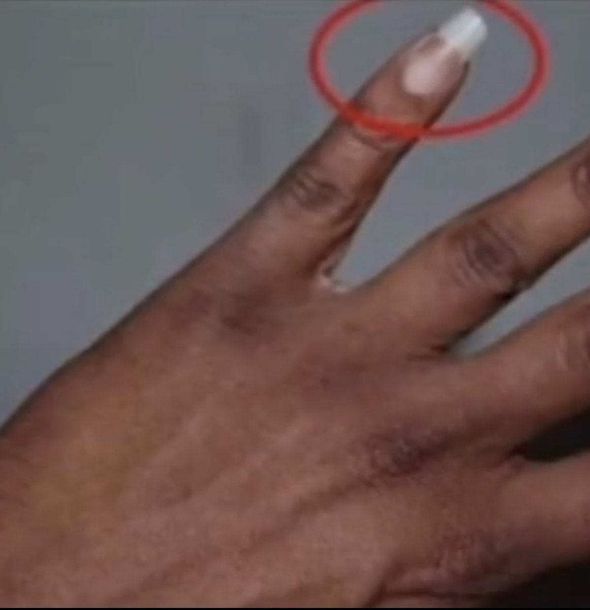 LindaEvelyn_N's tweet photo. Jokes aside, why do most men grow this nail?😒🤔 https://t.co/CtgulTQG4X