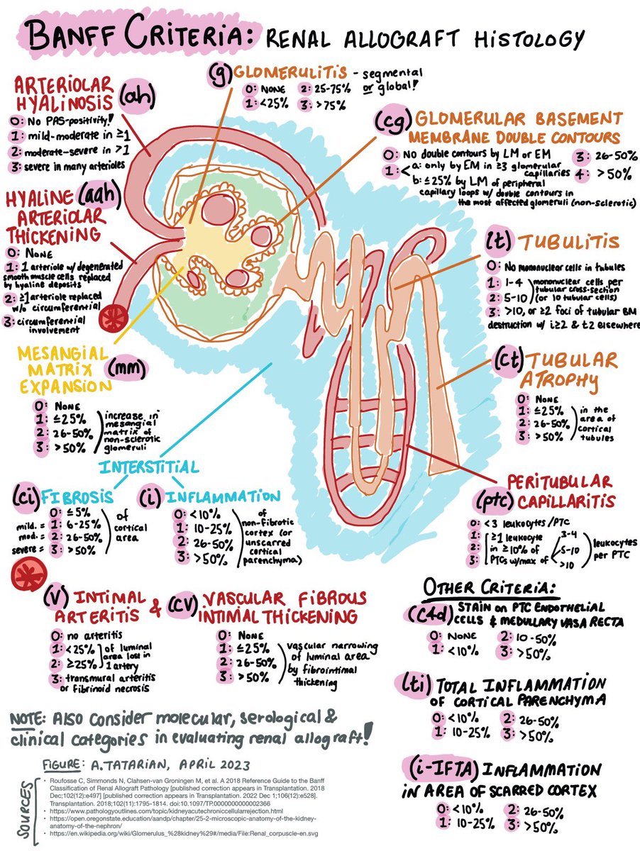 It’s #PathFigureFriday! 🫘 Here I share diagrams for concepts I’m learning. ✍🏼 Please add any comments, corrections, or creations of your own! 📚 #PathTwitter #RenalPath #PathArt #transplanttwitter

Inspired by my time on the Transplant Surgery service!

(⬅️simplified last week)