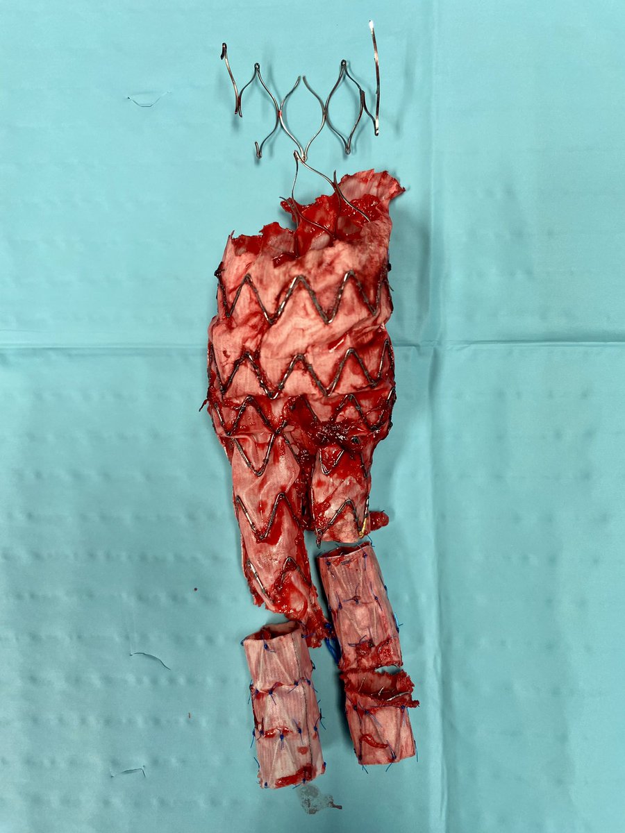 Type IA 120x130mm symptomatic. #veterosurgery #inthebucket