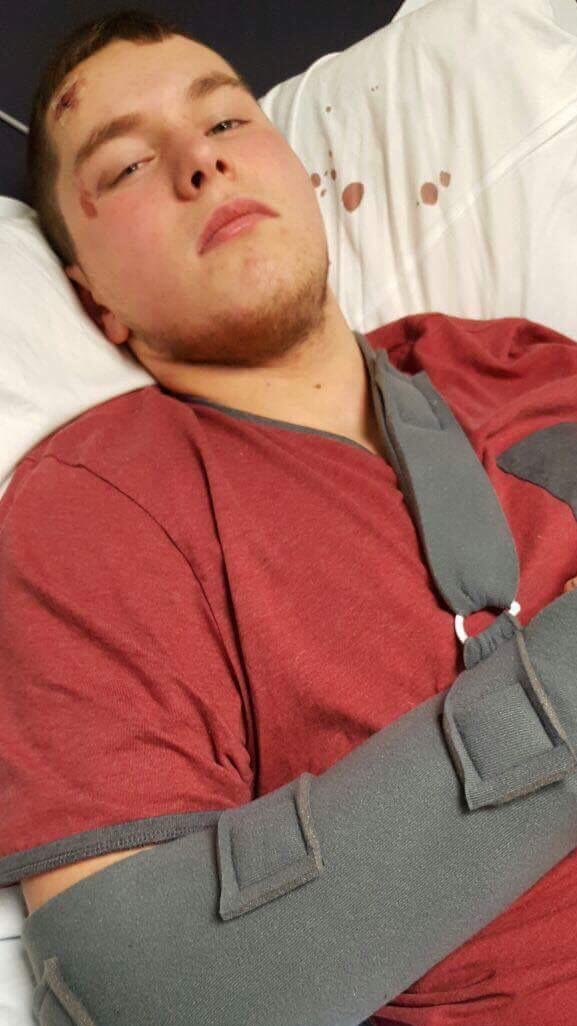 Irwin Mitchell Personal Injury & Med Neg (@piandmedneg) on Twitter photo Louis Priestley suffered a brain injury when he was hit by a car while cycling to his grandmother's house. He's now determined to get his "life back" after one of our serious injury lawyers <a href="/EmmaMelia7/">Emma Melia</a> helped him access specialist rehabilitation. bit.ly/3WkWMZV #ABIWeek Louis Priestley suffered a brain injury when he was hit by a car while cycling to his grandmother's house. He's now determined to get his "life back" after one of our serious injury lawyers <a href="/EmmaMelia7/">Emma Melia</a> helped him access specialist rehabilitation. bit.ly/3WkWMZV #ABIWeek