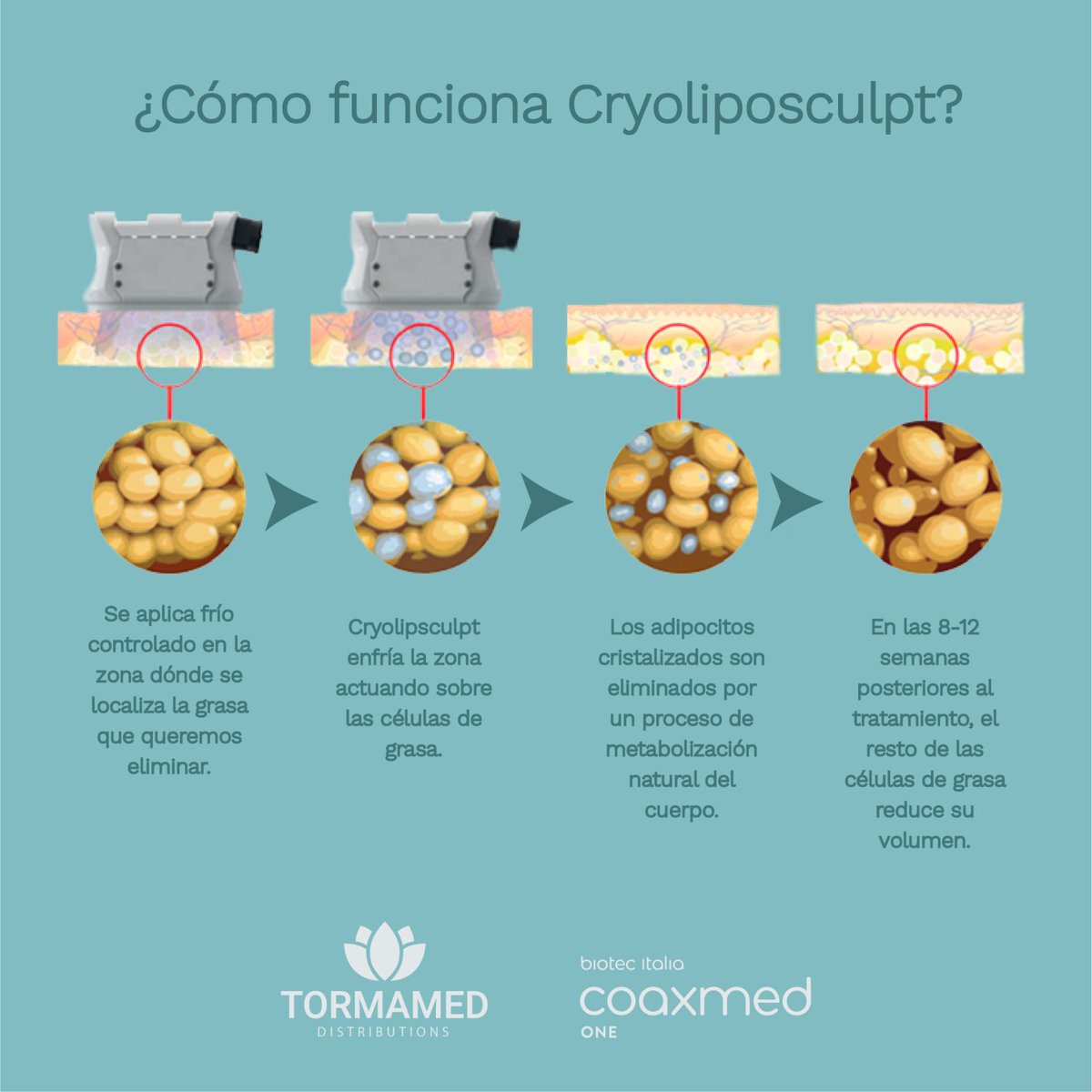 tormamed's tweet photo. En Tormamed, estamos comprometidos con la excelencia y la vanguardia en el campo de la Criolipólisis. El dispositivo CoaxMed One, con su aplicador Cryoliposculpt®, es el único que combina el vacuum, el enfriamiento controlado e impulsos eléctricos https://t.co/mqNNVWZtJb