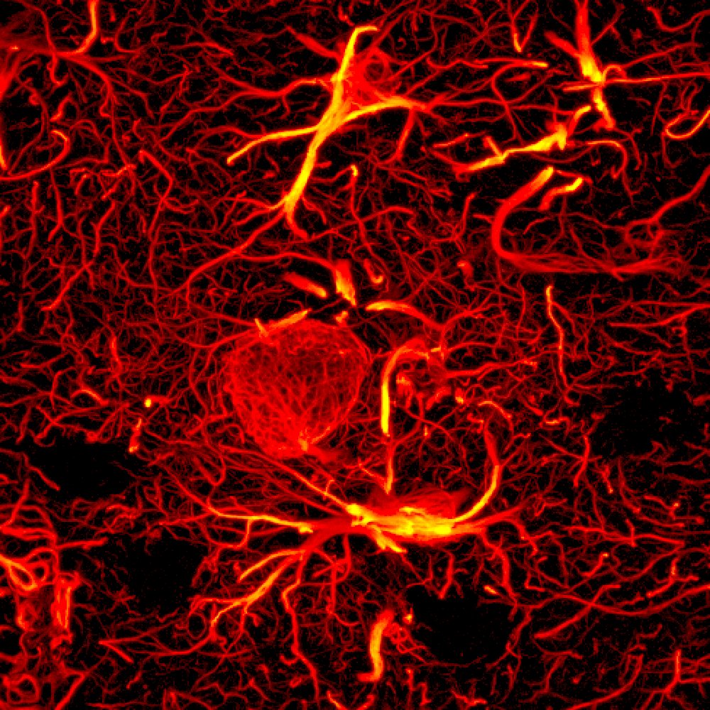 DaniBeckman's tweet photo. Impressive astrocyte network in response to inflammatory events in the brain.
Channels: GFAP (astrocytes, red), DAPI (nuclei, light blue), NEUN (neuron, dark blue), IBA1 ( microglia, green). Obtained with Zeiss LSM800 Confocal #FluorescenceFriday #microscopy @zeiss_micro https://t.co/EGWve4iYkW