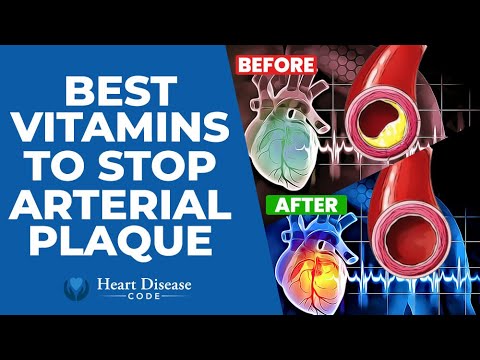 Best Vitamins To Stop Calcium Plaque In Your ...
 
#Angina #Angiogram #Atherosclerosis #BetaBlocker #BloodClotting #BloodPressure #BypassSurgery #CalciumChannelBlocker #CoronaryArteryDisease #Dyspnea #ECG #EKG #Electrocardiogram #HealthyArteries
 
vitaminrush.com/213021/best-vi…