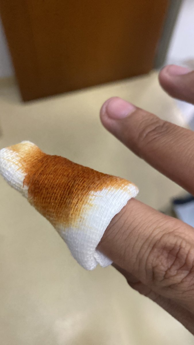 _andrianr_'s tweet photo. Setelah sekian lama akhirnya digigit juga. Semoga jadi penghapus dosa. Maafkan aku ya tikus 🥲 https://t.co/Xsx4k4FEjF