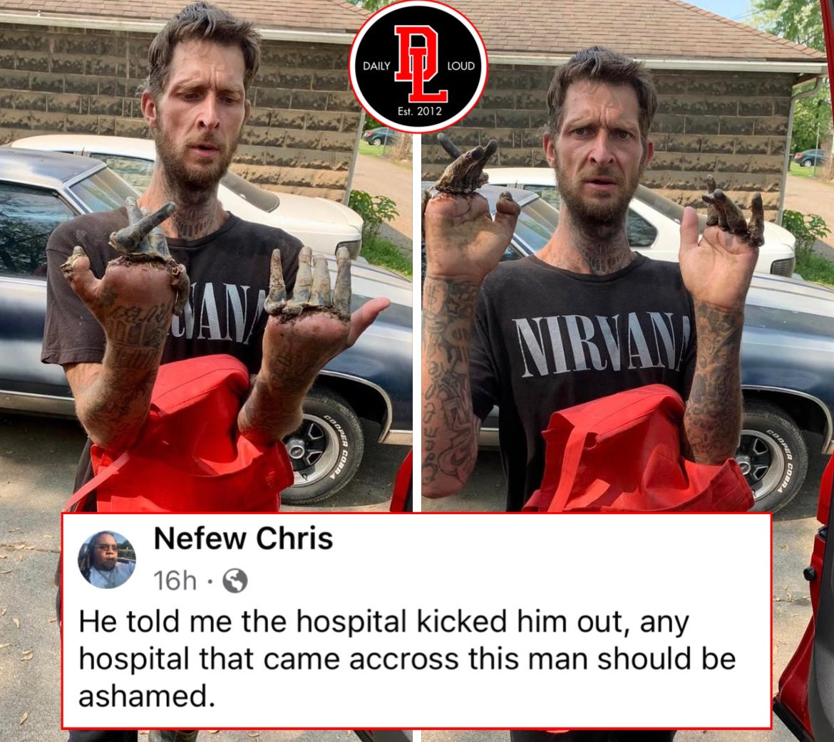 DailyLoud's tweet photo. Mans was allegedly denied access to a hospital after his fingers were falling off. https://t.co/7LJ53jSGj4