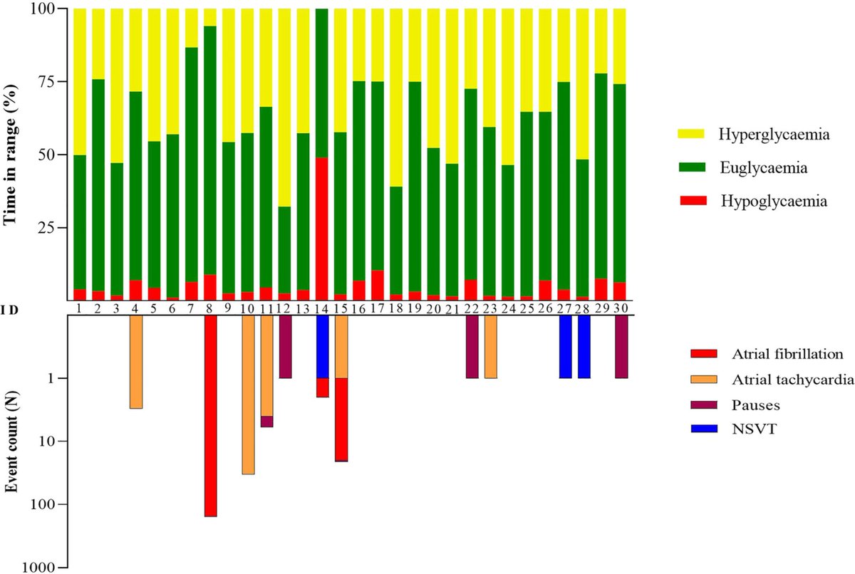 Filip K. Knop (@filip_knop) on Twitter photo Using implantable loop recorders and CGMs, Dr. <a href="/PHagelqvist/">P G Hagelqvist</a> captured 1-year data on glycaemia and heart rythm in 30 individuals with #T1D and show that acute hypo- and hyperglycaemia during daytime may increase the risk of arrhythmias💗
pubmed.ncbi.nlm.nih.gov/37203283/
<a href="/kellyclose/">kelly close</a> Using implantable loop recorders and CGMs, Dr. <a href="/PHagelqvist/">P G Hagelqvist</a> captured 1-year data on glycaemia and heart rythm in 30 individuals with #T1D and show that acute hypo- and hyperglycaemia during daytime may increase the risk of arrhythmias💗
pubmed.ncbi.nlm.nih.gov/37203283/
<a href="/kellyclose/">kelly close</a>