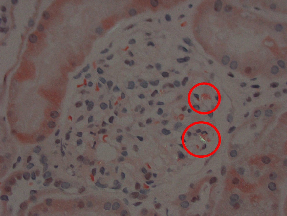 Kuang-Yu Jen, MD, PhD tweet media