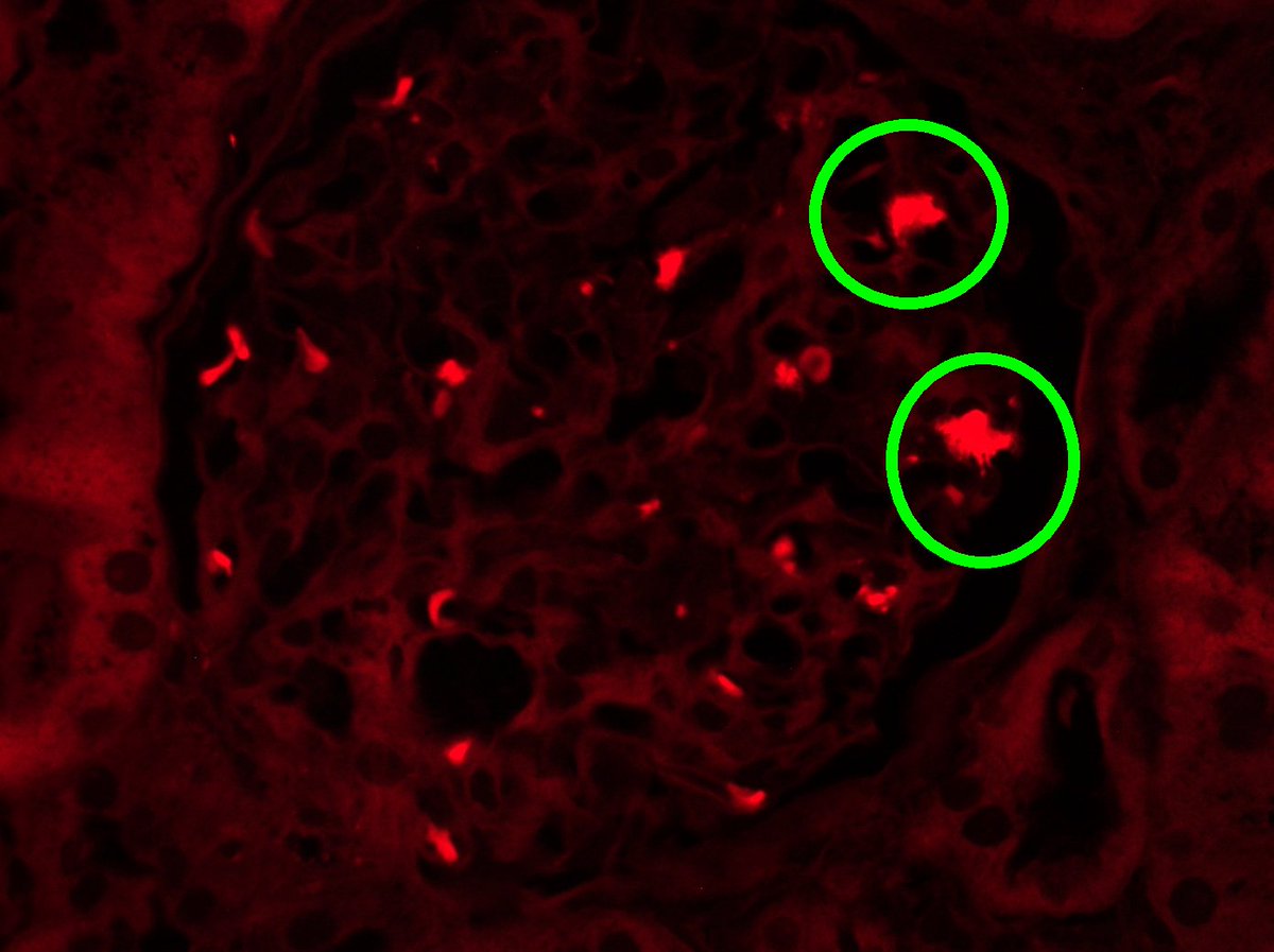 Kuang-Yu Jen, MD, PhD tweet media