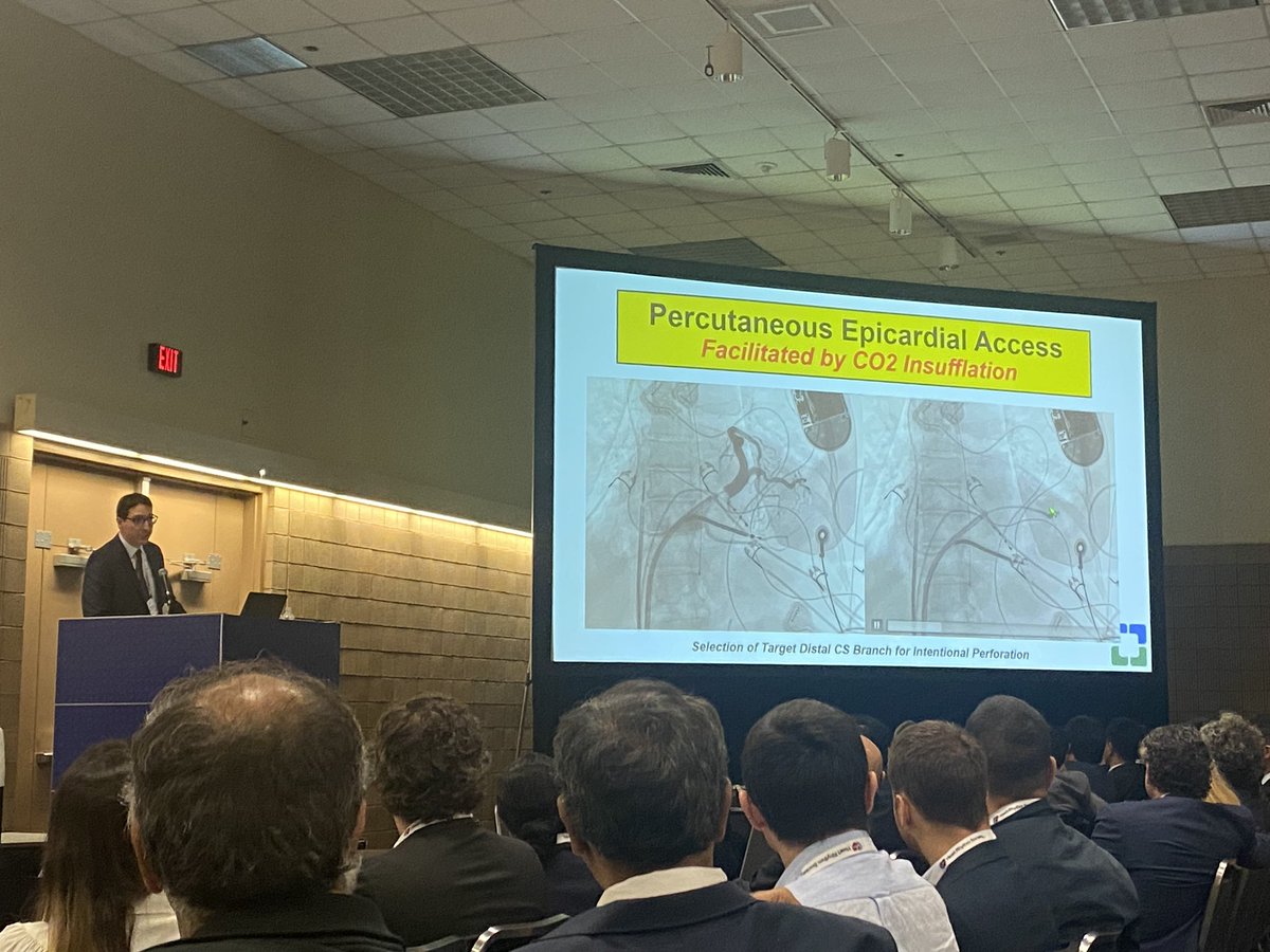 Epicardial puncture technique was quite similar with the first defined one by Sosa, @Scanav1Mauricio and @Davilandre But still related to 5-10% complication risk. 
Co2 use to decrease complication risk by @Dr_Santangeli in #HRS2023 
@HRSonline 
#2023PaceSetter