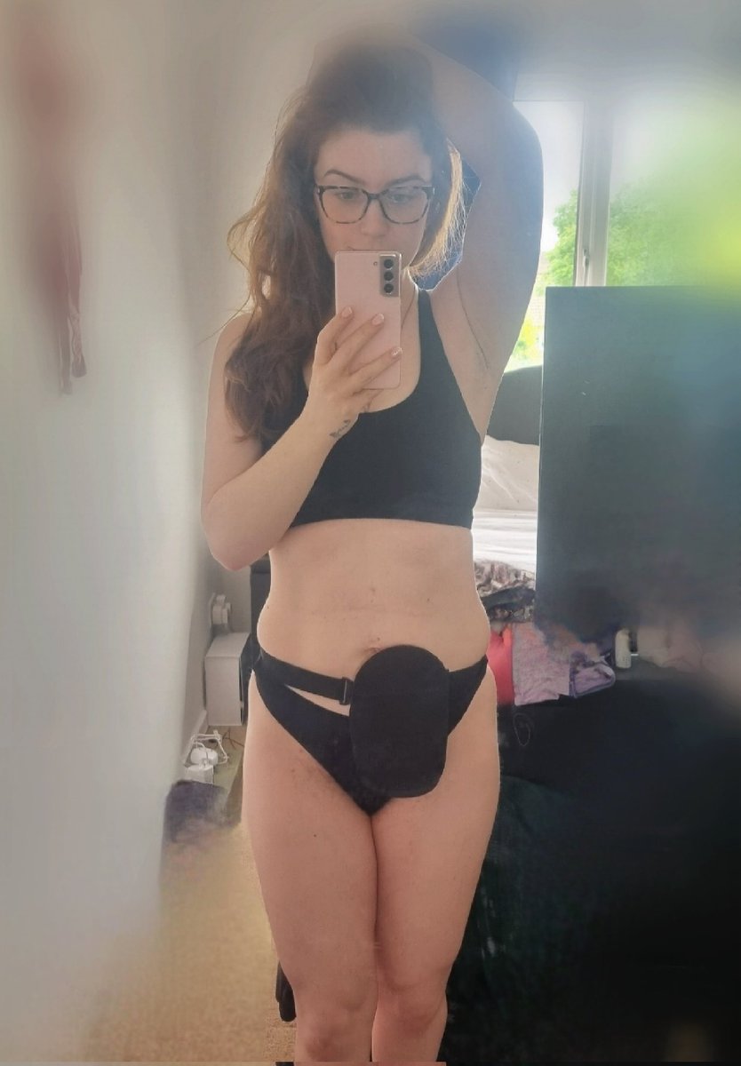 Today is #worldIBDday and I am so bloody proud of my body for surviving an awful 6 years of #Ulcerativecolitis. A 3 year flare up resulted in my entire large bowel and part of my small bowel being removed in September 2022, and I finally have the strength to live life again.