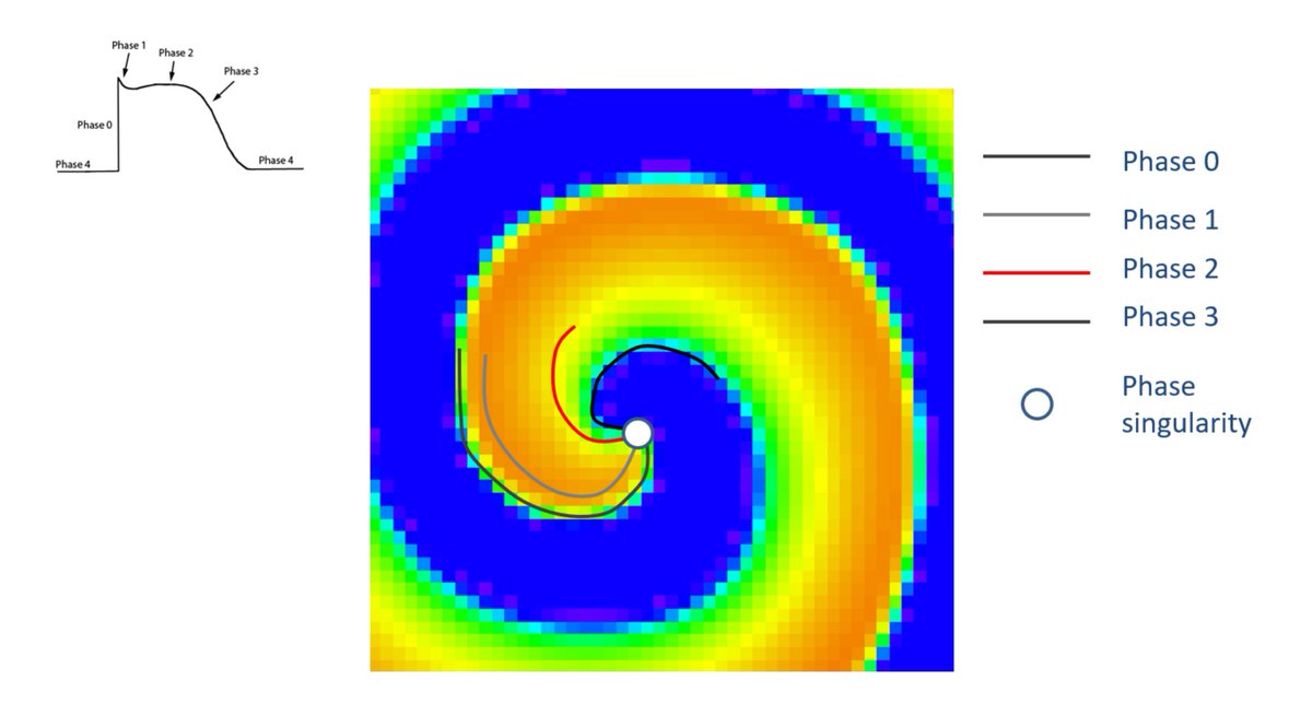 PHASE SINGULARITY: useful concept to learn.

Consider functional reentry. Draw lines of cells in AP phase 0,1,2,3,4.

All lines converge at tip of reentry wave -> PS point. 

Consider how confused cells are at PS point: surrounded by cells in all possible phases.

 #EPeeps