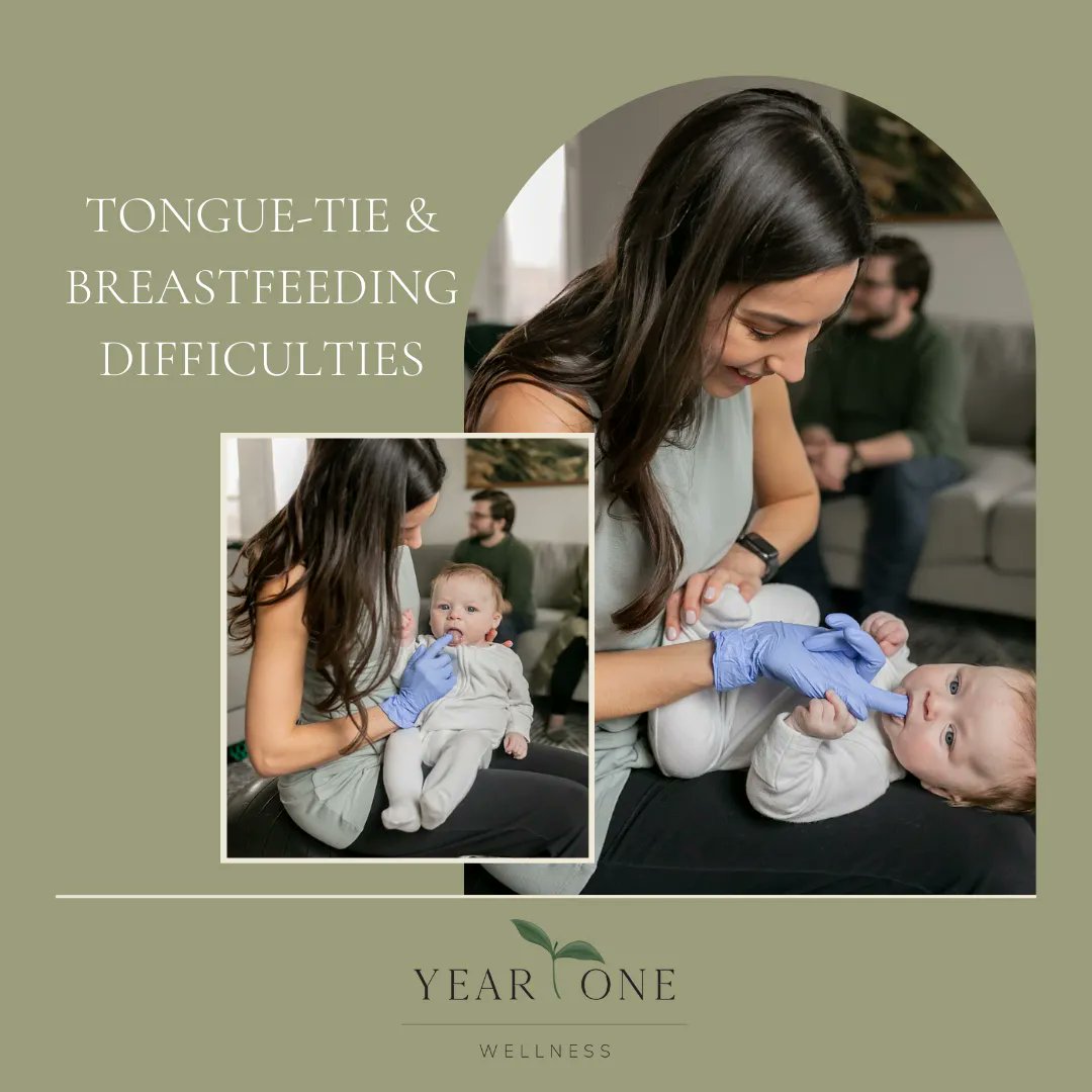 #Tonguetie can cause TMJ, gap teeth, sleep apnea, constant stuffy nose, & orthodontic appliances like a palate expander. #YearOneWellness PT's can improve oral motor skills aliviate tension, goal is to help babies be comfortable & healthy. #linkinbio to schedule a  session!