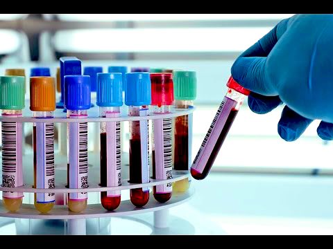 #البورد_السعودي

التخصصات 2️⃣
- معظم تخصصات المختبرات موجودة في البورد السعودي

- امراض الدم ، علم الامراض التشريحي، 
شرط الدخول : بكالريوس طب 

- الكيمياء الحيوية الإكلينيكية ، علم الاحياء الدقيقة الطبية ، بنك الدم 
شرط الدخول : بكالريوس مختبرات 

- الماجستير في نفس التخصص يعطي