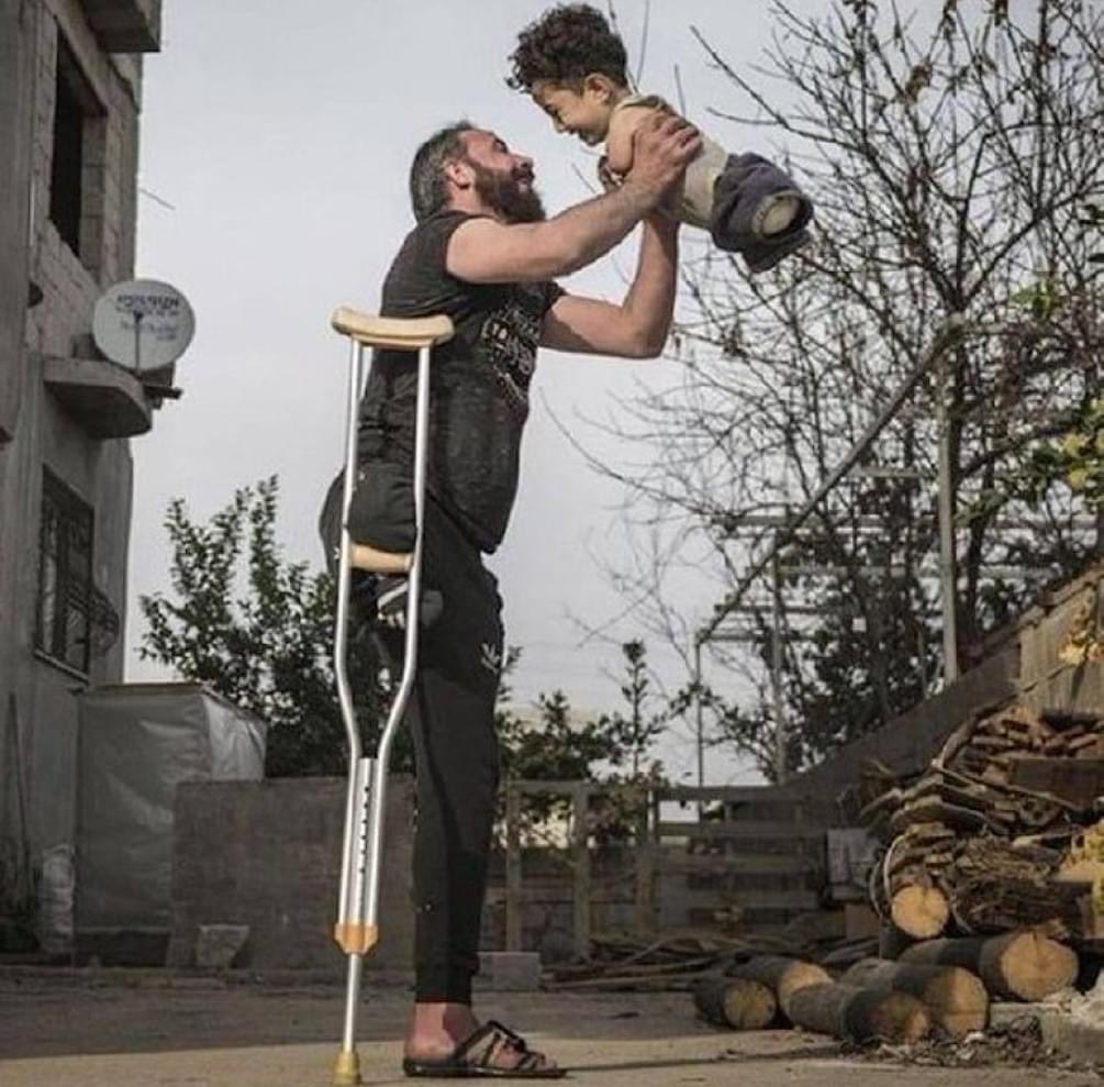 Syrian father & son, who were maimed by #Russian missiles. (PS: Picture won the Siena International Foto Awards.)

This is what Putin’s Satanic death cult gives to the world.