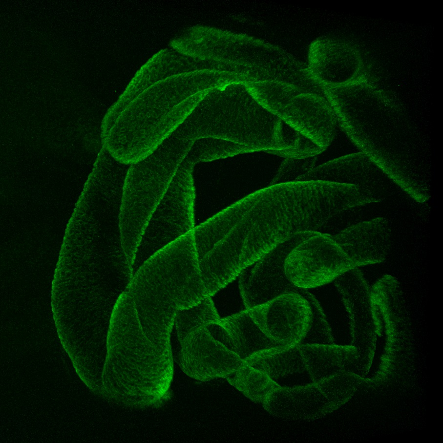 Wholemount of mouse e16.5, whole stomach (on the left) and intestine stained for KLF5 (red) and CDX2 (green). #FluorescenceFriday #cellbiology #sciart #bioart