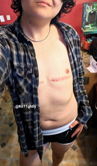 Gonna be meeting up with a real cutie tomorrow, wish me luck everyone <3 #ftm #trans #queer #nude https://t<a href="/tag/nude"class="tags"><span>#nude</span></a><a href="/tag/queer"class="tags"><span>#queer</span></a><a href="/tag/trans"class="tags"><span>#trans</span></a><a href="/tag/ftm"class="tags"><span>#ftm</span></a>