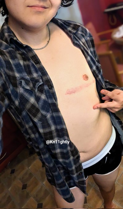 Gonna be meeting up with a real cutie tomorrow, wish me luck everyone <3 #ftm #trans #queer #nude https://t<a href="/tag/nude"class="tags"><span>#nude</span></a><a href="/tag/queer"class="tags"><span>#queer</span></a><a href="/tag/trans"class="tags"><span>#trans</span></a><a href="/tag/ftm"class="tags"><span>#ftm</span></a>