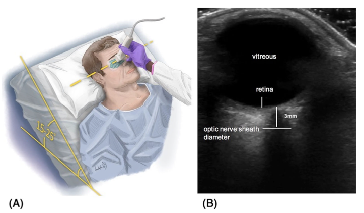 Weill Cornell Neurology tweet media