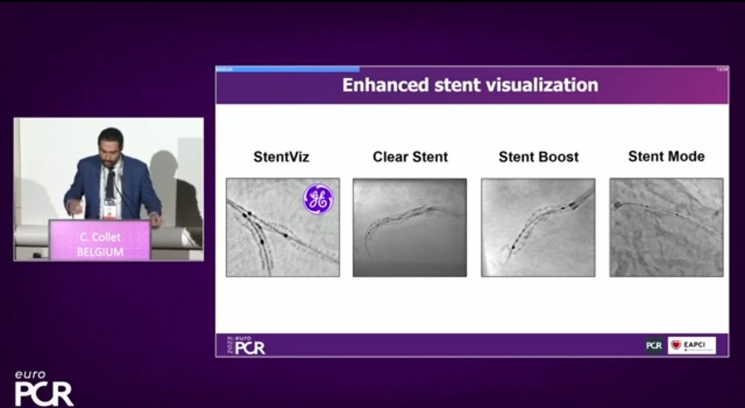 Zill_cardio's tweet photo. #EuroPCR 
#StentEnhancement

💥Stent Underexpansion and Value of 2D Stent Enhancement : Currently Available Angiographic and #IVImaging Options to Evaluate Stent Expansion 👇

@PCRonline #CardioTwitter https://t.co/s8uJEj6o72