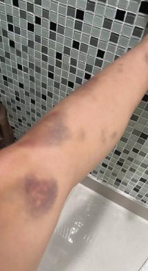 choquei's tweet photo. 🚨FAMOSOS: Tati Zaqui denuncia Thomaz Costa à polícia por agressões, ameaças e abusos. https://t.co/bQT4wFZx5h