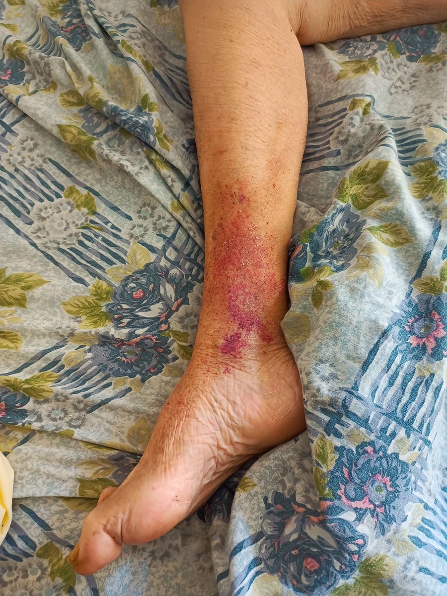 LuisReyes_30's tweet photo. Esto me partió el alma.
Ella es María, tiene 76 años, padece diabetes tipo 2, no tiene hijos ni familiares en #Venezuela. Está abandonada a su suerte. 💔
URGENTE difundir por favor!
@MamaLisVzla @LuisOlavarrieta @ManuelConecta @AlexaGomezDos 
#Sascha
#Ayuda
#Sismo
#Caricuao https://t.co/nFlDPHsKto