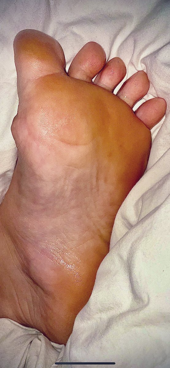 BunionBabeee's tweet photo. my feet are so and wet! what else would feel nice on them toes💦🤤😈🍆 #feet #feetfethish #feetcontent #feet_pic #feetfetiche #feet_lover #FEETYFRIDAY #FeetPictures #feet_pic #follow #like #PayPal #CashAppFriday #cashapp #2000rs #bunions #feetfam #findom #feetseller #dom #custom https://t.co/BuVj6c0Iom